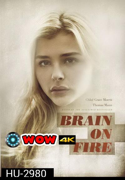 Brain on Fire เผชิญหน้า ท้าปาฏิหาริย์